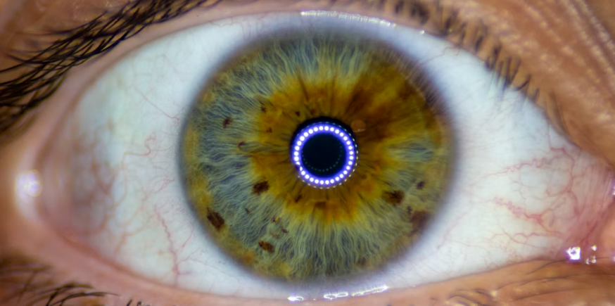 LASIK